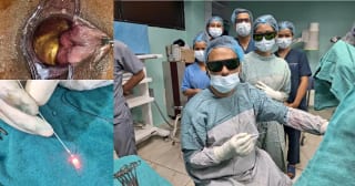 Hemorrhoid laser treatment in Nepal