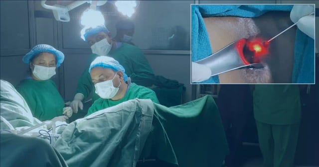 Patient education illustration for laser hemorrhoid treatment and recovery