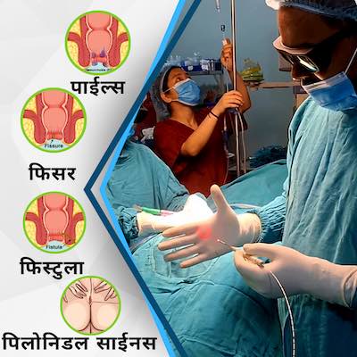 Laser Treatment for Hemorrhoids, Fistula, Fissure and Pilonidal Sinus